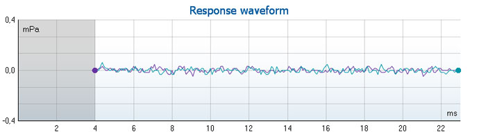 Graph with mPa as a function of milliseconds. The waveform ranges from 4 to 23 milliseconds in the time domain and sticks closely to zero mPa.