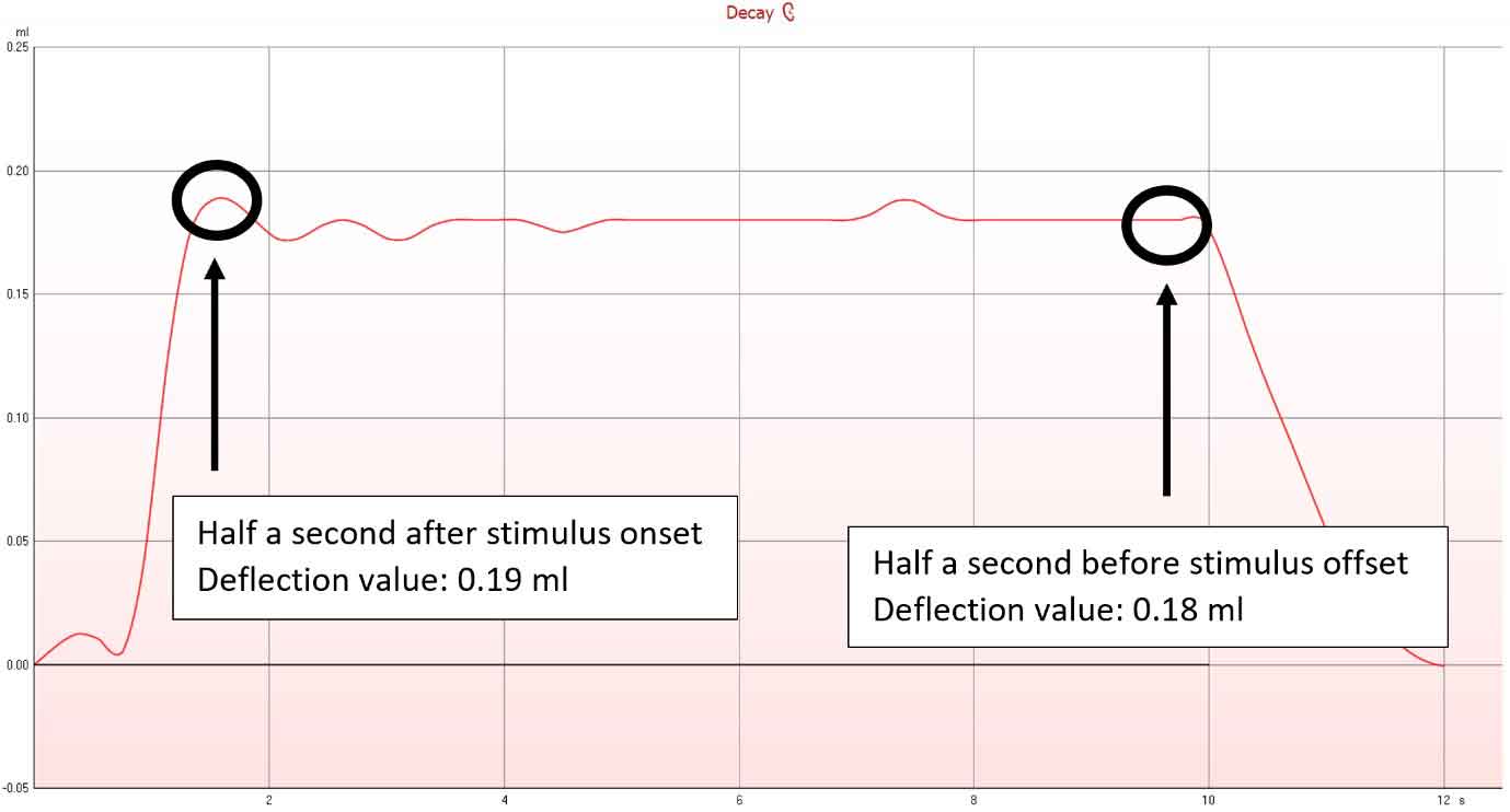 An acoustic reflex decay graph with a deflection value of 0,19 ml half a second after stimulus onset, and a deflection value of 0,18 ml half a second before stimulus offset.