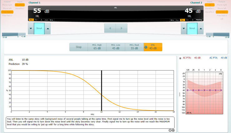 For this test, the patient is instructed to turn up the background noise level until it is too loud. Then turn down the background noise level until the speech material is very clear. Finally, turn up the background noise level until the patient reaches the maximum level that they would be willing to put up with for a long time while following the speech material. In this example, the patient's ANL value is 10 dB and the patient's performance prediction with amplification is 39%.