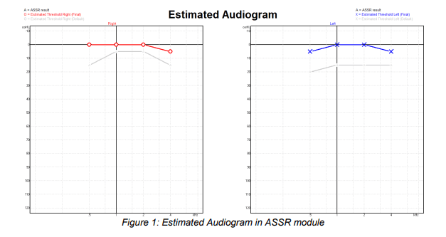 Estimated-audiogram Estimated audiograms for right and left ears, showing estimated thresholds between 0-5 dB eHL for all frequencies.