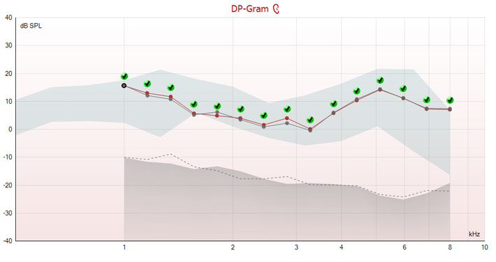 15 DP points between 1 to 8 kilohertz. Two curves are overlaid: a red one for the current test and a grey one for a previous test. The two curves are almost identical, with DP points ranging from zero to about 16 dB SPL.