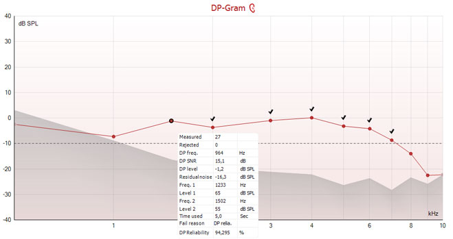 The DP point in question is well above the noise floor of minus 10 dB SPL with an SNR of 15.1. But the point has not been accepted, as it only has a reliability of 94.295%.