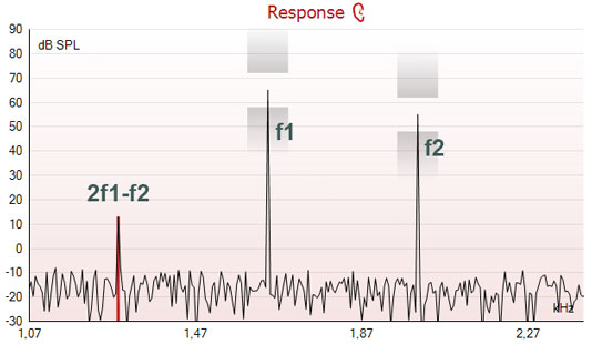 Graph with dB SPL as a function of kilohertz. f1 is located at 1640 hertz, peaking at about 65 dB SPL. f2 is located at 2000 hertz, peaking at about 55 dB SPL. 2f1 minus f2 is located at 1280 hertz, peaking at about 12 to 13 dB SPL.