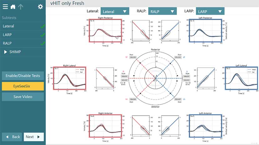 Results for left posterior, left lateral, left anterior, right anterior, right lateral, and right posterior.]
