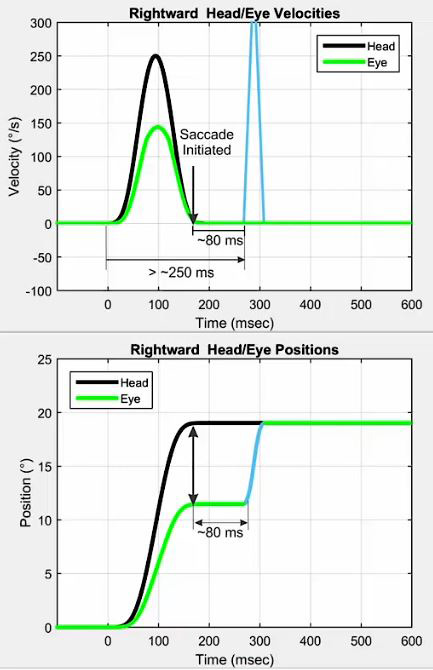 Velocity and position graphs. In the velocity graph, the head and eye movements are plotted with velocity, in degrees per second, as a function of time, in milliseconds. At 0 milliseconds, the head impulse is initiated, with a peak head velocity of 250 degrees per second. The peak eye velocity during the head impulse is only 150 degrees per second. 80 milliseconds after the head impulse has ended, a large corrective eye movement is visible with a velocity of more than 300 degrees per second. In the position graph, the head and eye movements are plotted with position, in degrees, as a function of time, in milliseconds. At 0 milliseconds, the head impulse is initiated, and the head quickly moves into an 18-degree position. The eye only reaches 12 degrees at first, with a corrective eye movement 80 milliseconds after to reach 18 degrees.