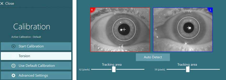 Images of right and left eyes. For both eyes, a small cross is at the center of the pupil, encircled by a white circle. The tracking area for the right eye is 62 pixels, and 59 pixels for the left eye. A button is available labeled 'Auto Detect'. To the left there are four options available: start calibration, torsion, use default calibration, and advanced settings.