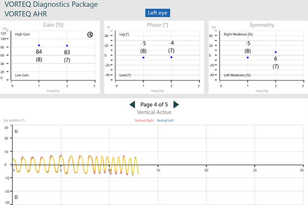 Summary plots for gain, phase, symmetry, and eye position. 84% gain at 1 hz and 83% gain at 2 hz. 5 degree phase lead at 1 hz and 4 degree phase lead at 2 hz. 5% left weakness at 1 hz and 6% right weakness at 2 hz. Eye position tracings follow the target position tracing quite closely.