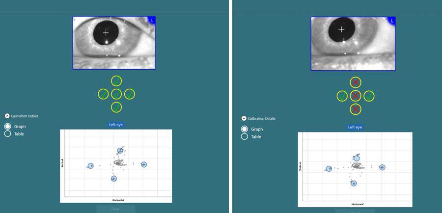 Calibration-details-graph-mode Two calibration overviews for the left eye displayed in a graph. One of the calibrations shows green checkmarks for all five eye positions. The other calibration shows three red x for the vertical eye positions.