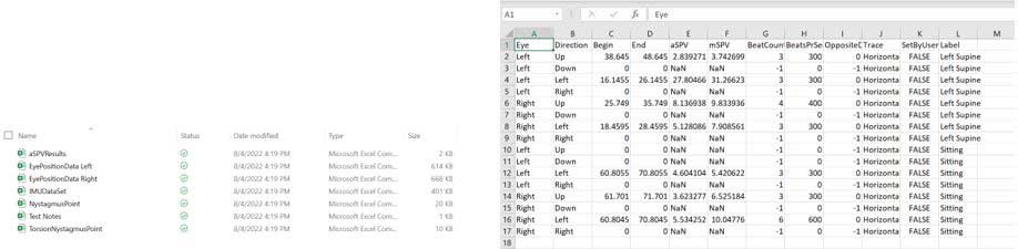 csv exports of average slow phase velocity results, eye position data, IMU data, nystagmus points, test notes, and torsional nystagmus points. An example of one of the spreadsheets is shown, with several columns containing various data, such as aSPV, direction, label, and others.