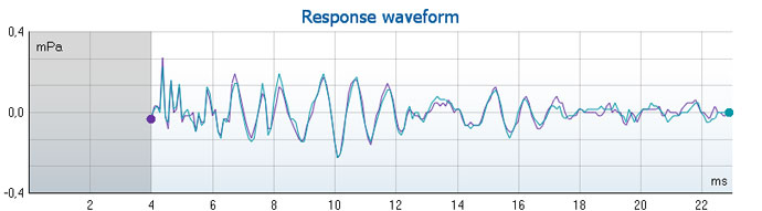 Graph with mPa as a function of milliseconds. The waveform ranges from 4 to 23 milliseconds in the time domain, and ranges from about minus 0.2 to plus 0.3 mPa.