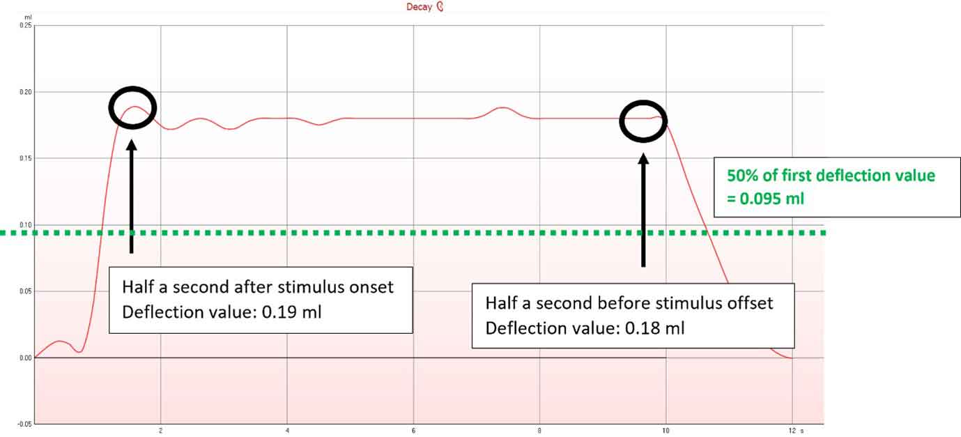 An acoustic reflex decay graph with a deflection value of 0,19 ml half a second after stimulus onset, and a deflection value of 0,18 ml half a second before stimulus offset. The 50% mark is 0,095 ml, indicated by green dotted lines.