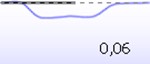 A downward-oriented acoustic reflex with a deflection value of 0,06.