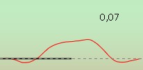An upward-oriented, normal acoustic reflex with a deflection value of 0,07.