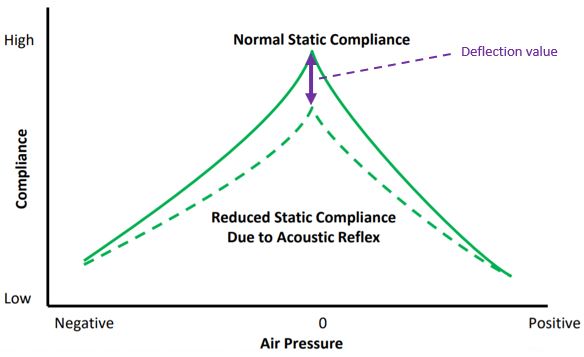 Two tympanograms in a graph where compliance is a function of air pressure. One of the tympanograms has a reduced static compliance due to the acoustic reflex, and this difference is called the deflection value.