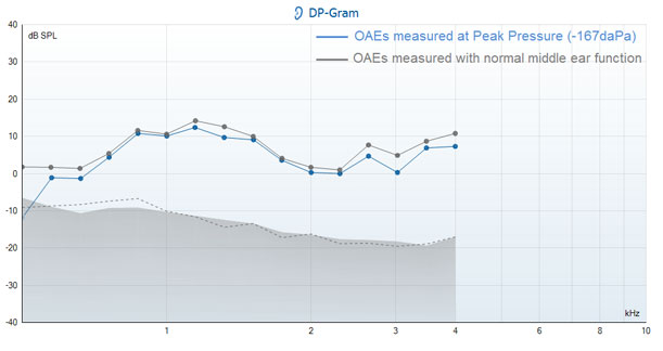 From 0.2 to 4 kilohertz, the DP points at both pressures are quite close to each other.