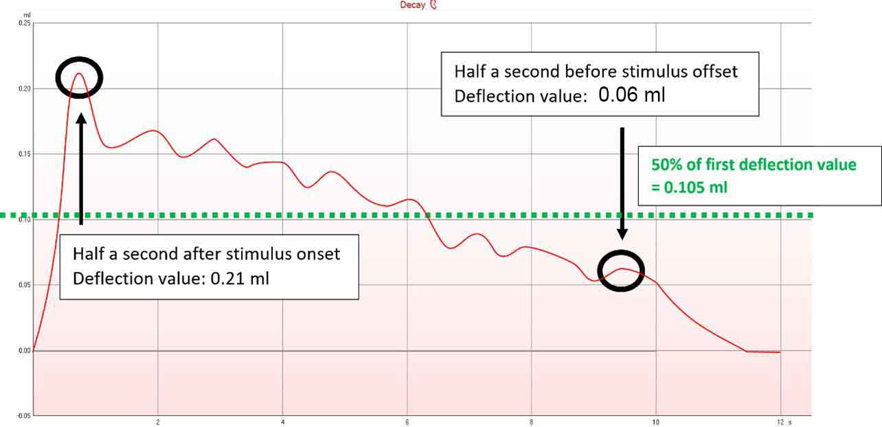 An acoustic reflex decay graph with a deflection value of 0,21 ml half a second after stimulus onset, and a deflection value of 0,06 ml half a second before stimulus offset. The 50% mark is 0,105 ml, indicated by green dotted lines.