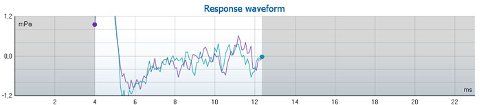 Graph with mPa as a function of milliseconds. The waveform ranges from 4 to just above 12 milliseconds in the time domain. The mPa levels vary drastically, with a very steep ascension followed by a very steep descent in the first few milliseconds.