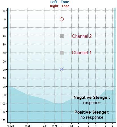 Stenger test screen
