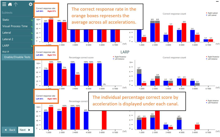 The patient achieved 100 degrees per second in the leftward direction, 200 degrees per second in the rightward direction, 200 degrees per second in the downward direction, and 180 degrees per second in the upward direction.