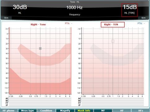 TEN test screen