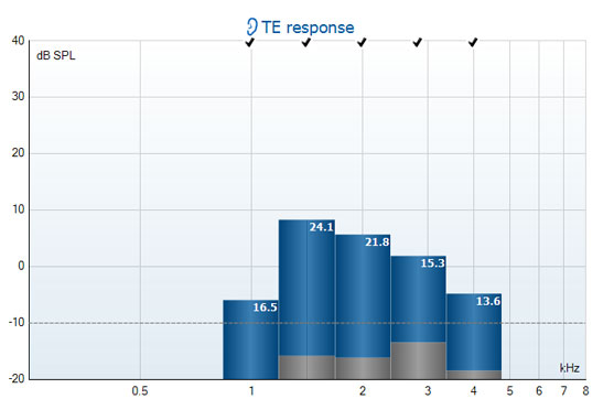 Five columns for the half-octave bands around 1, 1.5, 2, 3, and 4 kilohertz. All five bands have passed, with TEOAE response amplitudes ranging between minus 7 to plus 8 dB SPL, and signal-to-noise ratios ranging between 13.6 to 24.1.