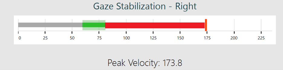 The acceptable velocity area is between about 60 to 80 degrees per second. The patient's peak velocity is too fast at 173.8.
