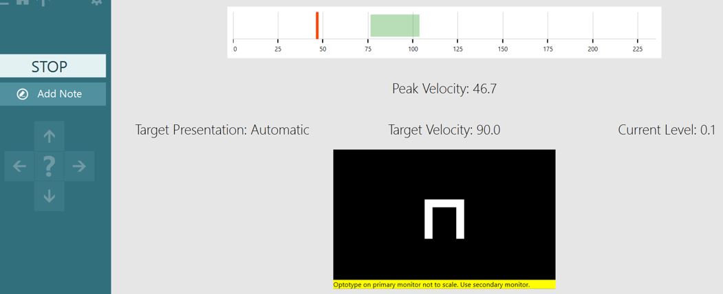 The target velocity is 90 degrees per second, with the acceptable green area lying between about 75 to 105. The patient has only achieved a peak velocity of 46.7.