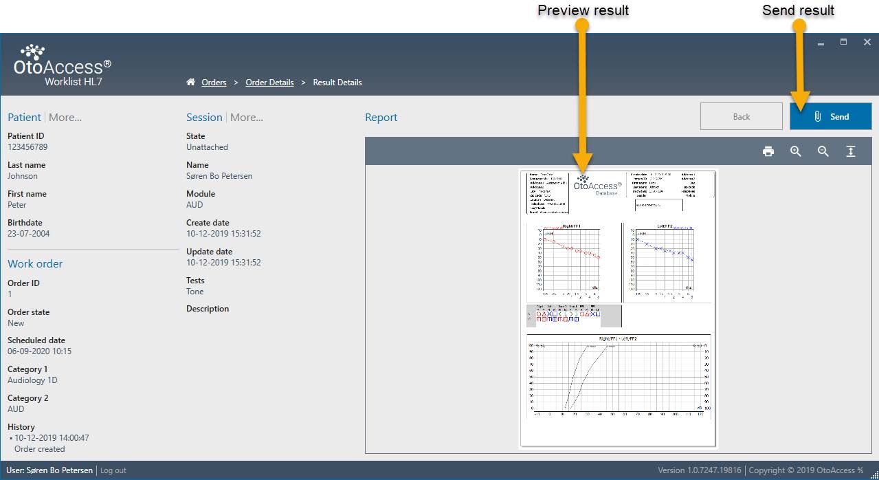 Result details overview in OtoAccess Worklist HL7. Lists of details are displayed to the left concerning the patient, work order and session. Patient details include the following: patient id, last name, first name, and birthdate. Work order details include the following: order id, order state, scheduled date, category 1, category 2, and history. Session details include the following: state, name, module, create date, update date, tests, and description. Two yellow arrows in the report overview show where to find a preview of the results and the 'send' button.