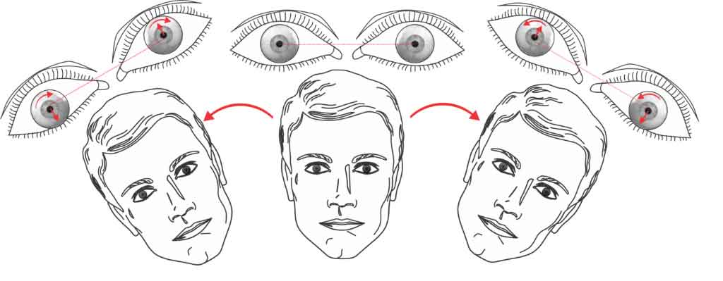 Three heads displaying eye movements when the head is tilted to the left, head upright, and head tilted to the right.