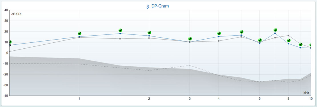 Overlaid DPOAE sessions in DP-gram