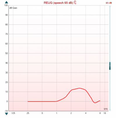 Real-ear-unaided-gain curve with kHz as a function of dB Gain. The curve peaks at 3 kHz with a value of just below 15 dB Gain. It dips just below 0 dB Gain at 6 kHz and then recovers.