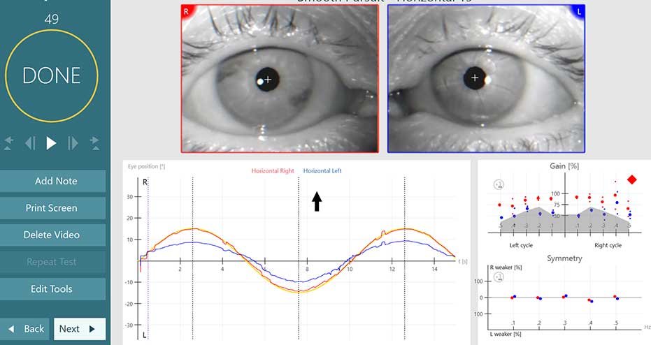 Eye tracking software displaying separate eye disorders
