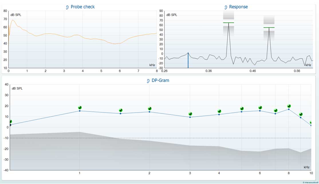 DPOAE software screen, showing probe check, DPOAE response, and DP-Gram.