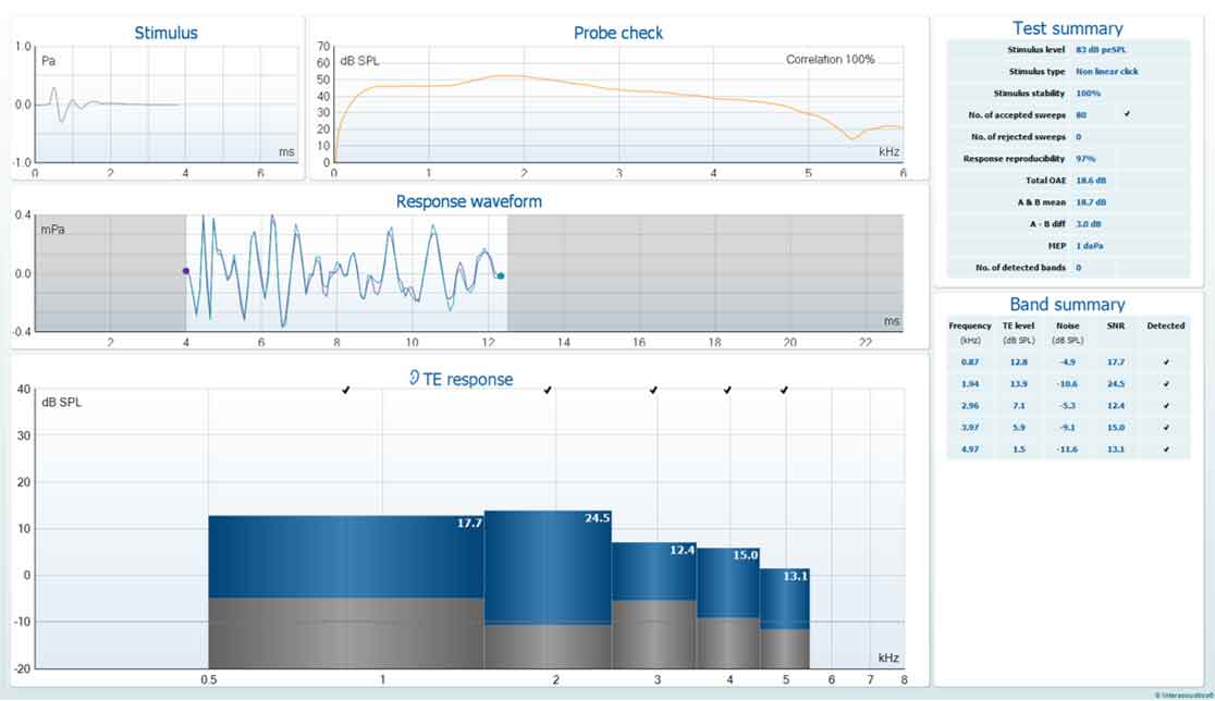 TEOAE software screen, showing stimulus, probe check, response waveform, TE response, test summary, and band summary.