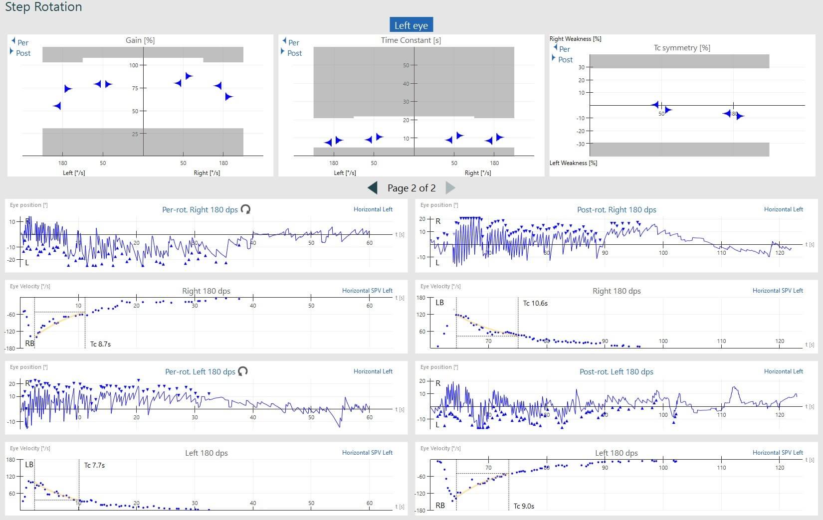 Velocity step test results screen, showing normal results for gain, time constant, symmetry, eye position and eye velocity.
