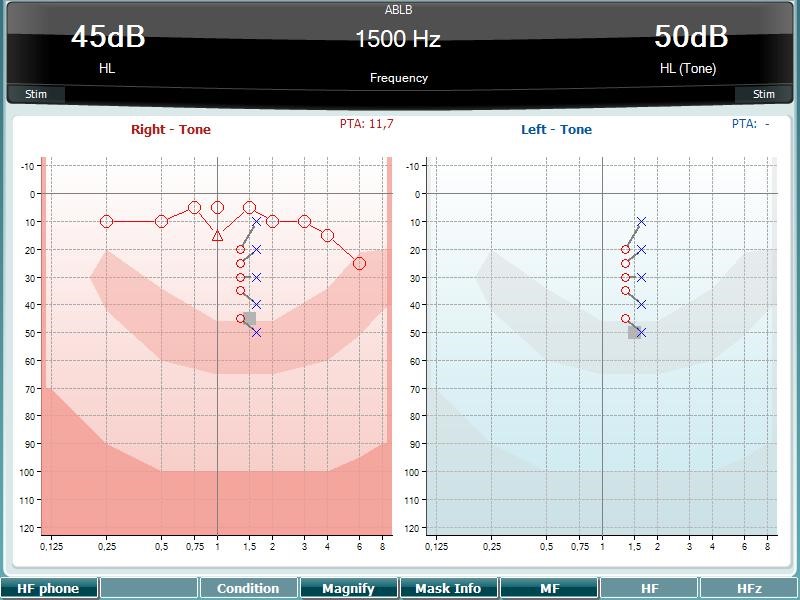 ABLB test screen