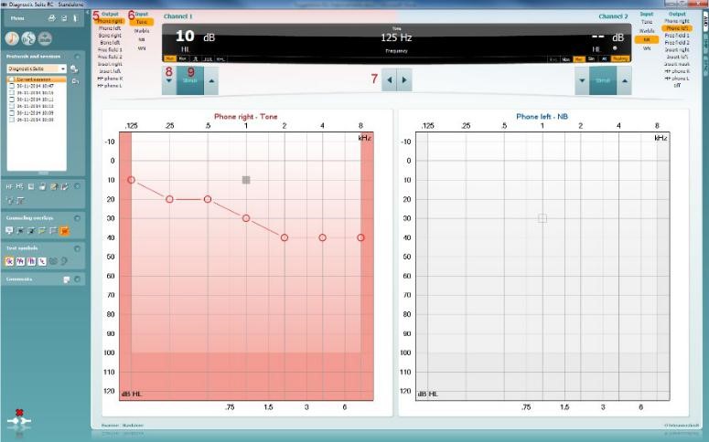 Tone audiometry in Diagnostic suite